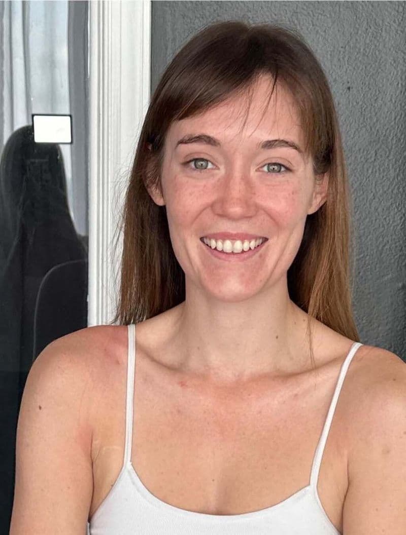Before: client eight when she arrived